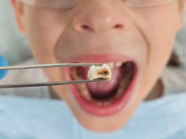 Best Weekend Emergency Dentist in Marshall, IL